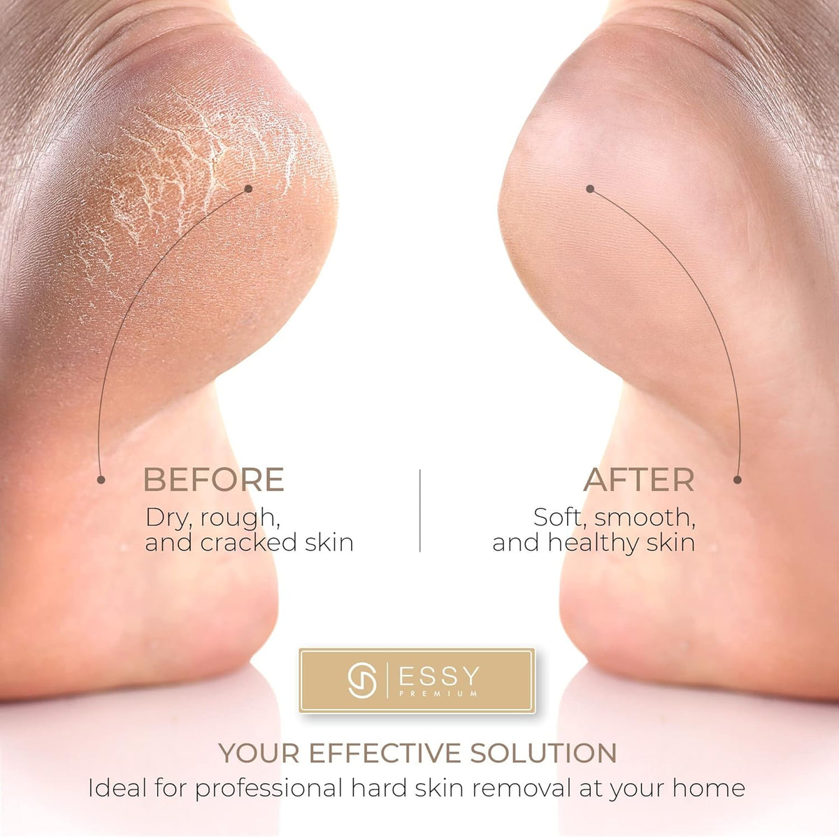 Essy Electric Foot File