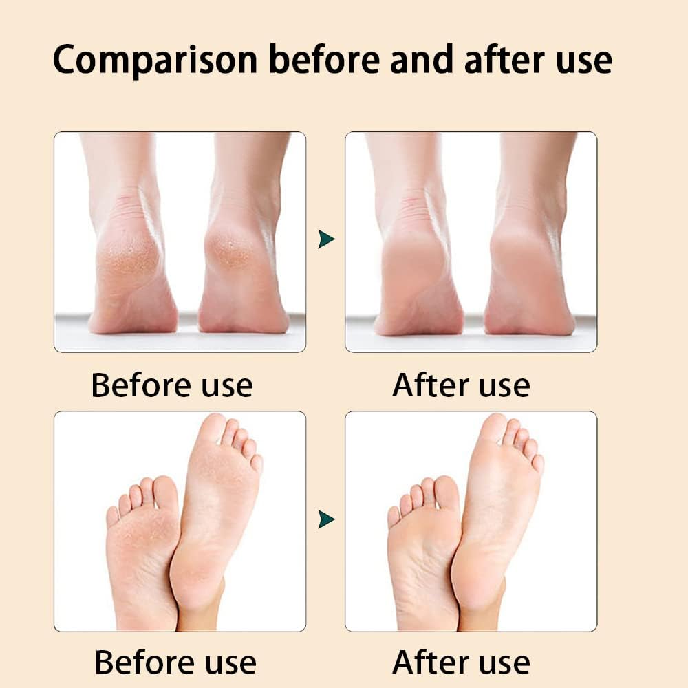 Foot File for Hard Skin