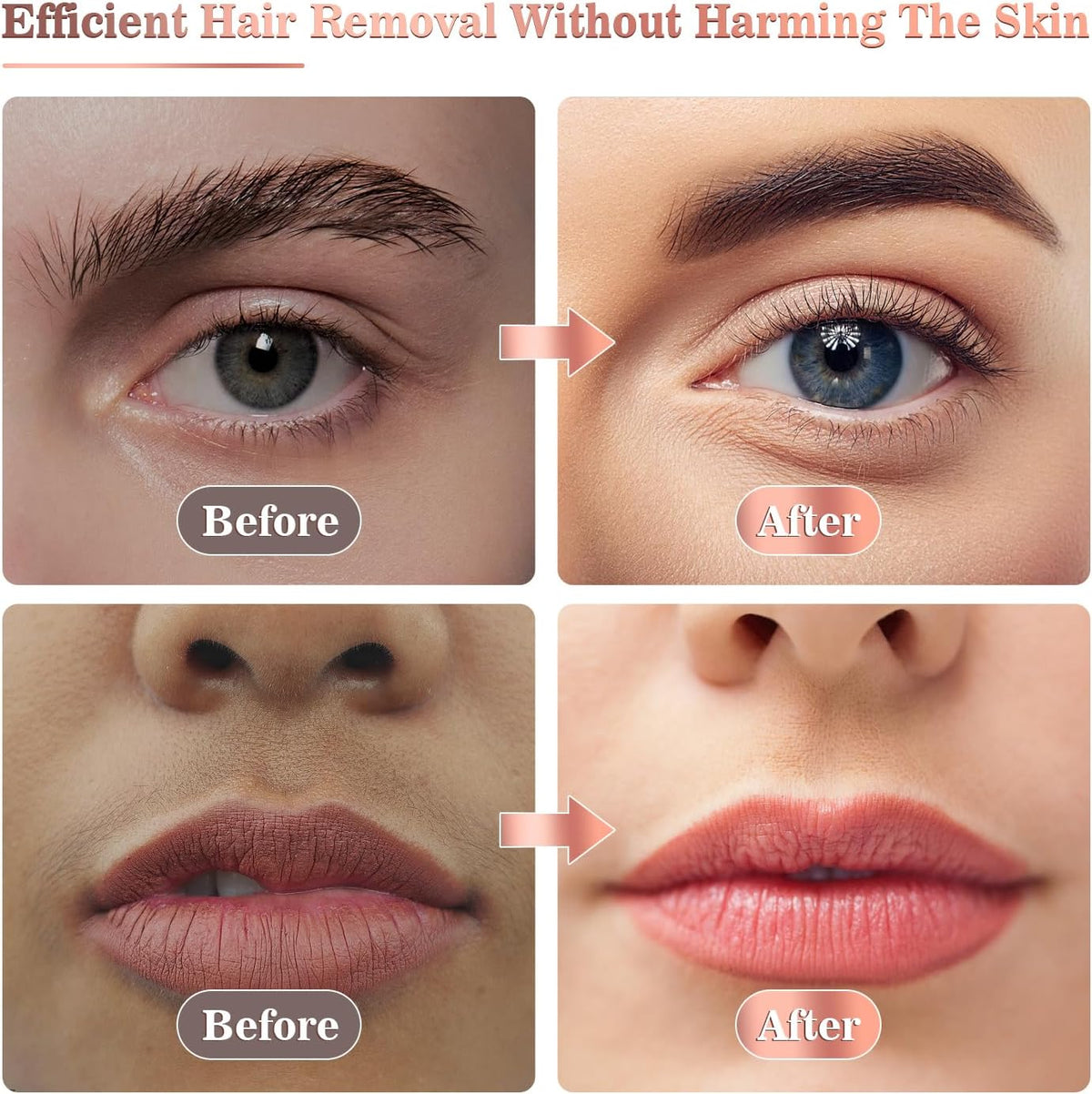 Vexloria Facial Hair Remover for Women